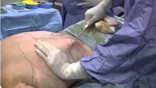 Advierten por la presencia de clínicas de cirugías estéticas reconstructivas no certificadas