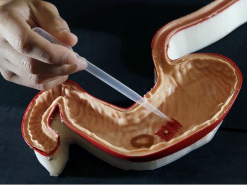 Crean robot ingerible capaz de cerrar heridas o dar fármacos