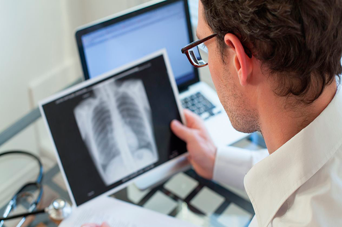 Tuberculosis, padecimiento letal