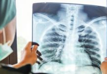 Inicia el año con 11 casos de tuberculosis respiratoria