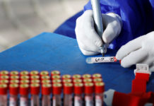 Crean una prueba para predecir si un enfermo de covid-19 desarrollará síntomas graves