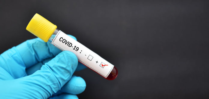 Blood sample tube positive with COVID-19 or novel coronavirus 2019 found in Wuhan, China
