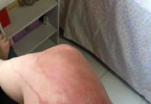 Medusas en playa Bagdad causan alarma en visitantes.