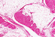 Una forma de perder peso ‘sudando’ grasa sin dieta ni ejercicios es descubierta accidentalmente durante experimentos con ratones