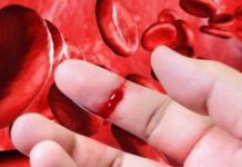 Hemorragias sin causa