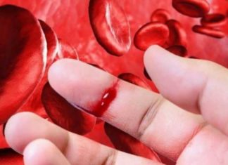 Hemorragias sin causa