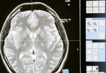 Samsung propone “copiar y pegar” la estructura del cerebro para crear chips neuromórficos