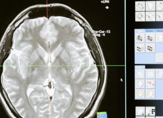 Samsung propone “copiar y pegar” la estructura del cerebro para crear chips neuromórficos