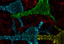 Científicos logran descifrar la función de los misteriosos “puntos calientes” que se encuentran en las neuronas del cerebro