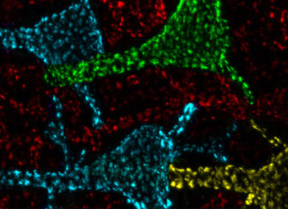 Científicos logran descifrar la función de los misteriosos “puntos calientes” que se encuentran en las neuronas del cerebro