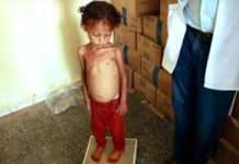 Más de mil tamaulipecos afectados por la desnutrición