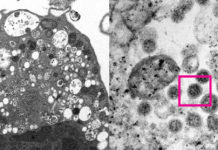Científicos ‘retratan’ la variante ómicron de coronavirus