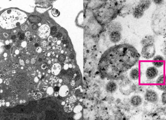 Científicos ‘retratan’ la variante ómicron de coronavirus