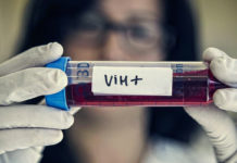 Inversión millonaria en prevención del VIH pero los casos siguen 600 al año