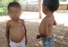 Desnutrición de se duplica en Tamaulipas