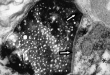 Descubren un nuevo tipo de comunicación celular en el cerebro