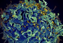 La primera mujer en curarse del VIH habría superado la enfermedad gracias a un trasplante de células madre tomadas de la sangre de un cordón umbilical