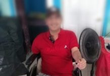 Oscar pide apoyo para prótesis de pierna