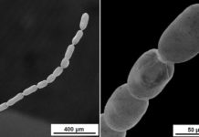 Descubren la bacteria más grande jamás conocida, que puede medir hasta dos centímetros de largo