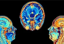 Covid: el estudio que muestra cómo cambia el cerebro tras una infección por coronavirus, aunque esta sea leve