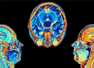 Covid: el estudio que muestra cómo cambia el cerebro tras una infección por coronavirus, aunque esta sea leve