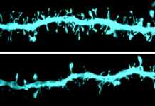 Las proteínas que predicen la enfermedad de Parkinson