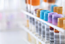 Científicos encuentran una “correlación genética” entre los resultados de análisis de sangre y los trastornos mentales