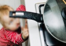 Niños las principales víctimas de quemaduras