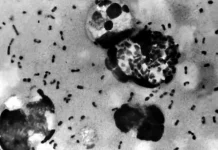 Dientes antiguos revelan por fin dónde se originó la peste negra, la más mortífera de la historia