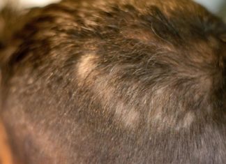 Descubren una molécula que ayuda a fomentar el crecimiento de cabello nuevo