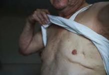 Cáncer de mama, ya reportan tres casos en hombres