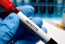 Reportan cuatro casos probables de hepatitis aguda grave en Tamaulipas