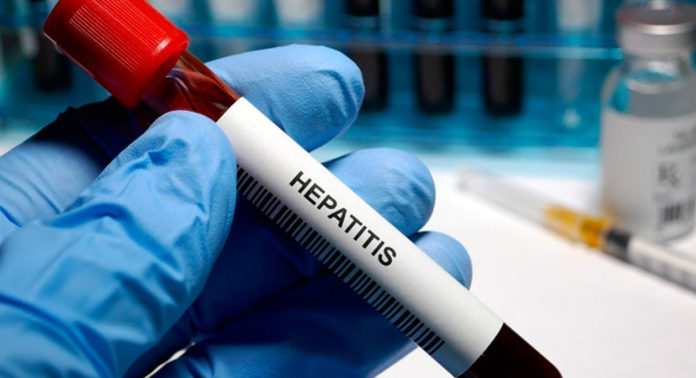 hepatitis-c