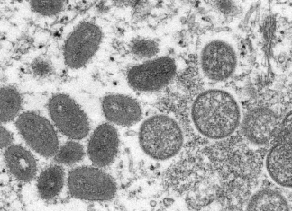 Viruela del mono: cuál es el perfil de los infectados y cómo puede cambiar a medida que avanza la enfermedad