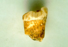 Un diente revela nuevos detalles sobre la alimentación de los neandertales