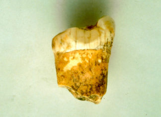 Un diente revela nuevos detalles sobre la alimentación de los neandertales