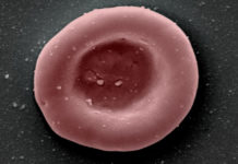 Realizan el primer ensayo de transfusión de glóbulos rojos cultivados en laboratorio a humanos