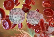 Qué es la inflamación y por qué puede ser un arma de doble filo