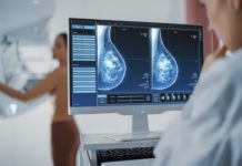 Cáncer de mama se duplica en Tamaulipas