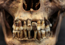 Arqueólogos descubren un secreto dorado en la boca de una aristócrata del siglo XVII