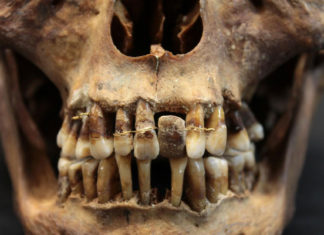 Arqueólogos descubren un secreto dorado en la boca de una aristócrata del siglo XVII