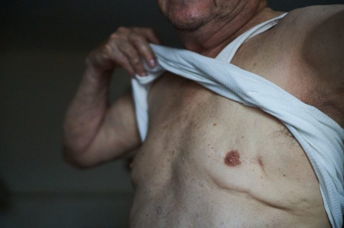 Cancer-hombres-atencion