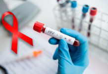 Siguen a la alza infecciones por VIH; ya suman 70 casos