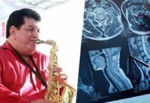 Fito Olivares: ¿Qué es el mieloma múltiple, el cáncer que padecía el saxofonista?