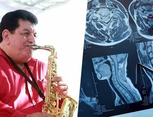 Fito Olivares: ¿Qué es el mieloma múltiple, el cáncer que padecía el saxofonista?