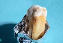 Bacterias dentales de los neandertales podrían ser la clave para desarrollar nuevos antibióticos