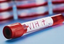 Se duplican afectados por el VIH en Tamaulipas