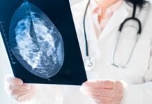 Cáncer de mama afecta ya a 326 personas; invitan a realizarse la mastografía y es gratis