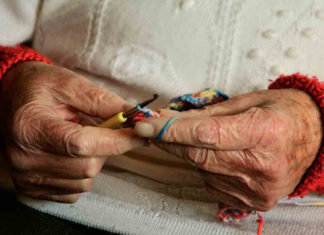 Abuelita de 84 años va al hospital por un malestar y descubren un feto de 40 años