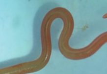 Investigadores encuentran por primera vez un gusano vivo en el cerebro de una mujer